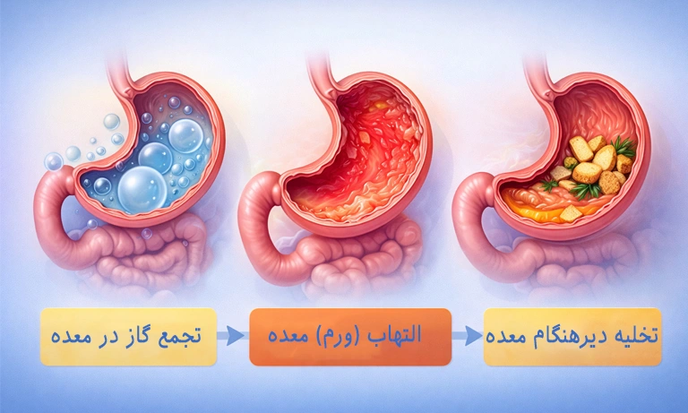 علت ورم معده