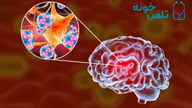 تاثیر تومورهای مغزی بر سیستم عصبی