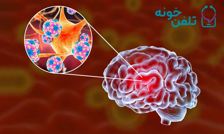 مهاجمان مغز؛ تاثیر تومورهای مغزی بر سیستم عصبی و راه‌های پیشگیری و درمان