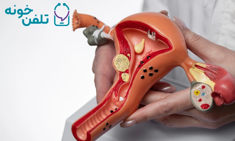 علائم پیشرفته سرطان رحم