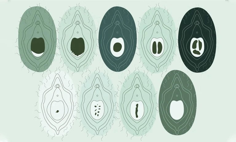 انواع مدل های پرده بکارت سالم