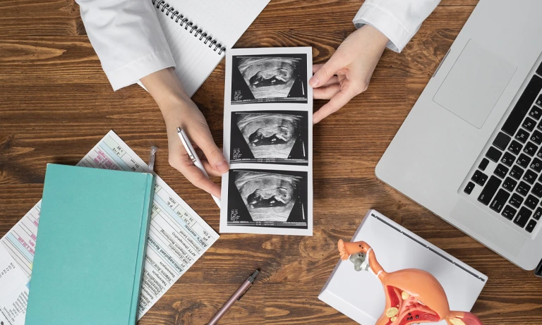 زمان بندی سونوگرافی رحم و تخمدان