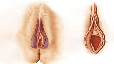 آیا پرده بکارت من سالم است؟