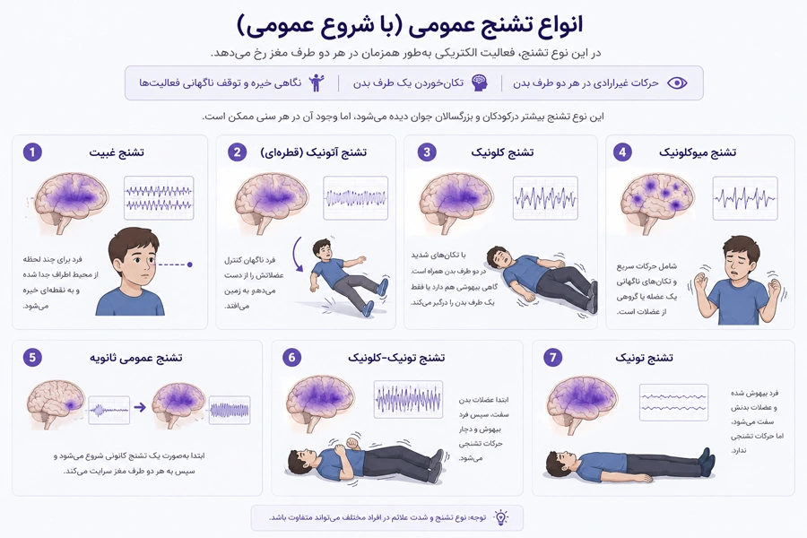 انواع تشنج با شروع عمومی