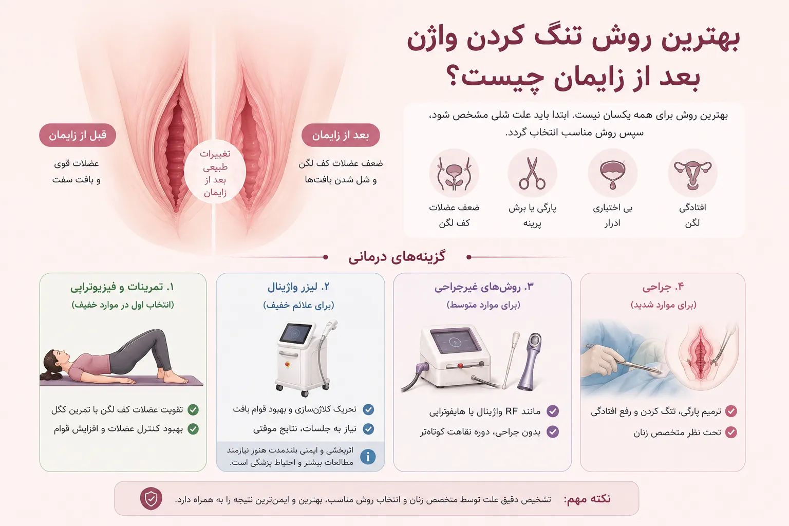 بهترین روش تنگ کردن واژن بعد از زایمان