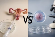 تفاوت IVF با IUI