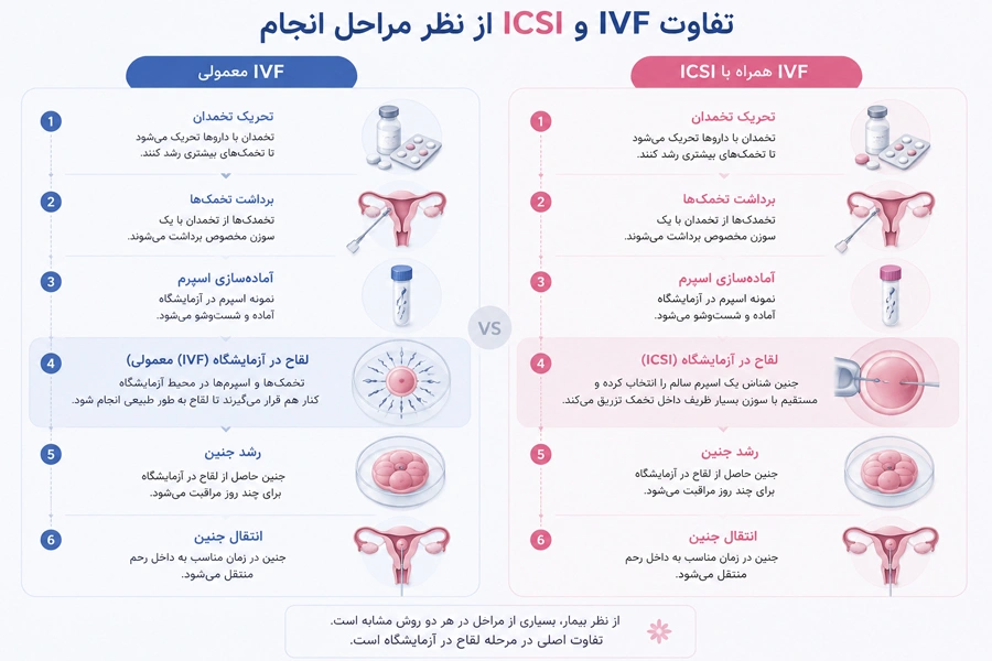 تفاوت IVF با IcsI
