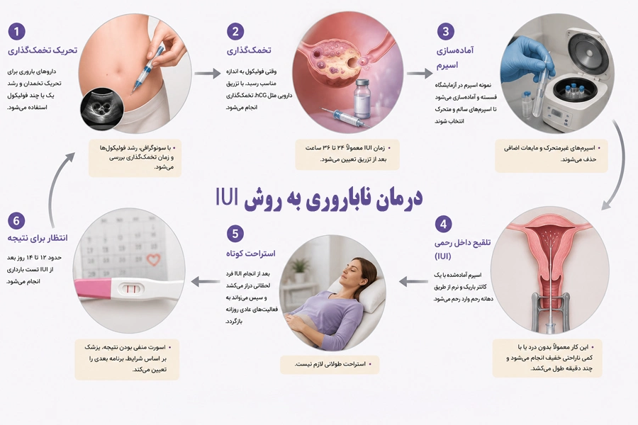روش iui