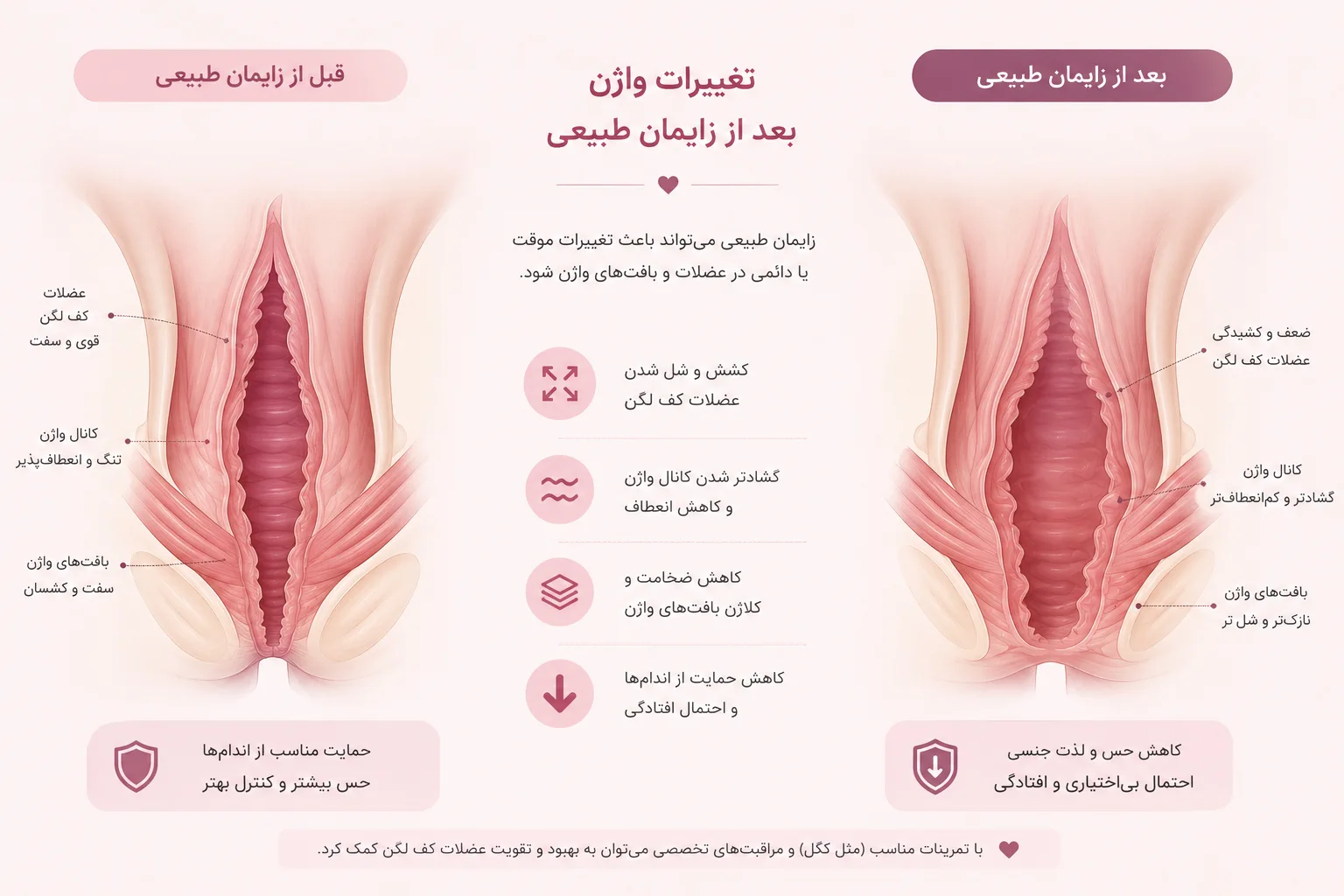 علت تغییر شکل واژن بعد از زایمان