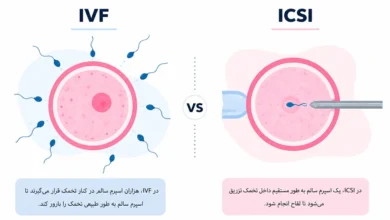 فرق IVF با IcsI