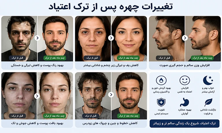 تغییر چهره پس از ترک اعتیاد