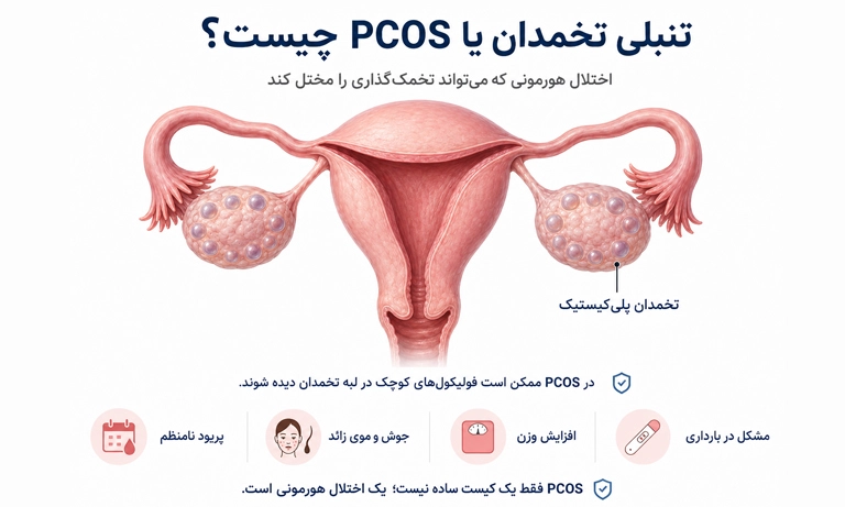تنبلی تخمدان چیست