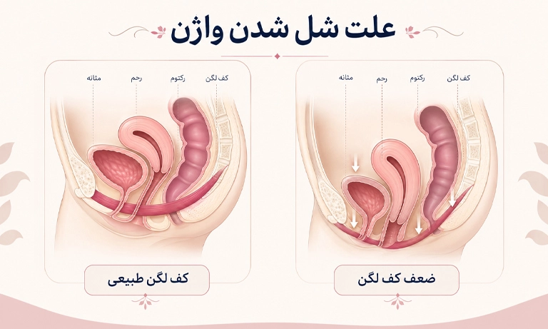 علت شل شدن واژن