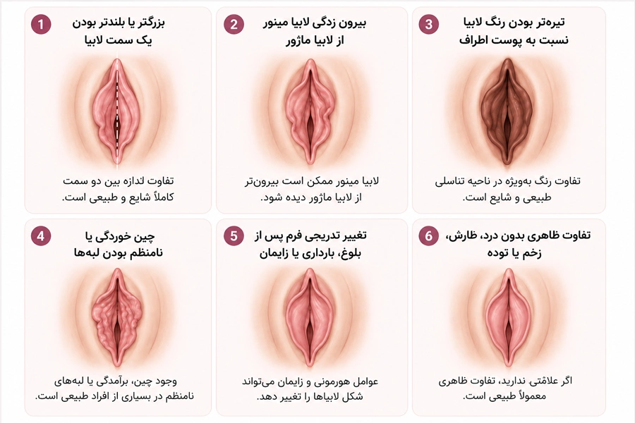 انواع لابیاماژو