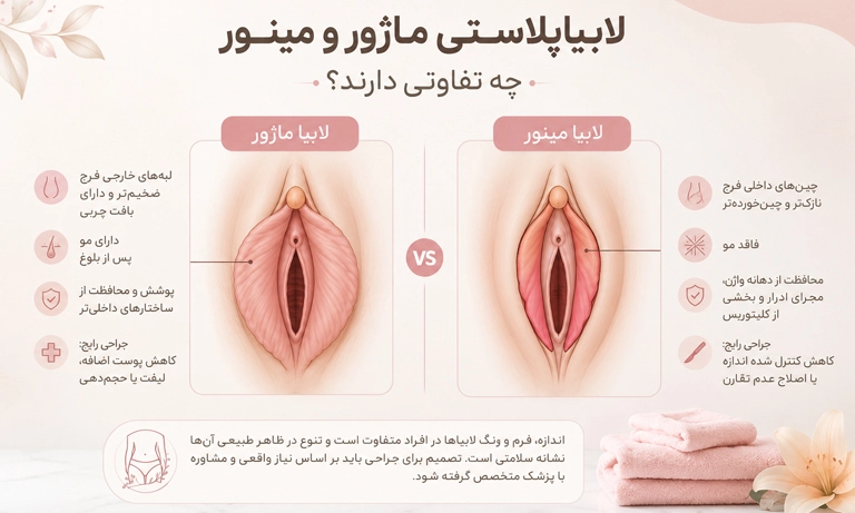 لابیا ماژور و مینور