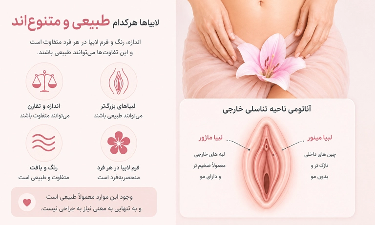 دلایل لابیاپلاستی
