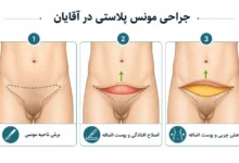 عمل مونس پلاستی آقایان