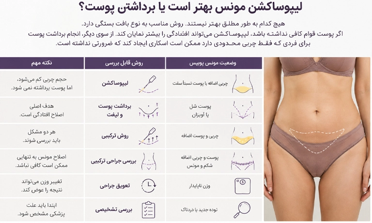 عمل مونس پلاستی