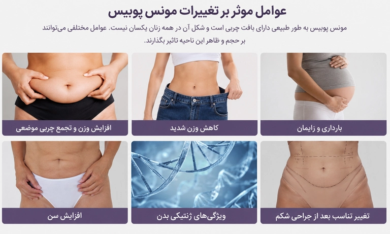 عوامل موثر بر مونس پلاستی