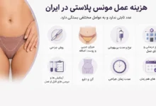قیمت جراحی مونس پلاستی