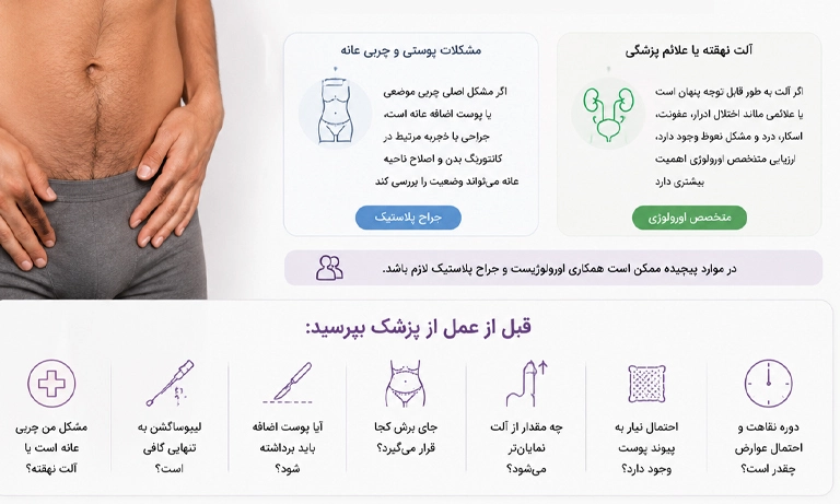 مونس پلاستی برای آقایان
