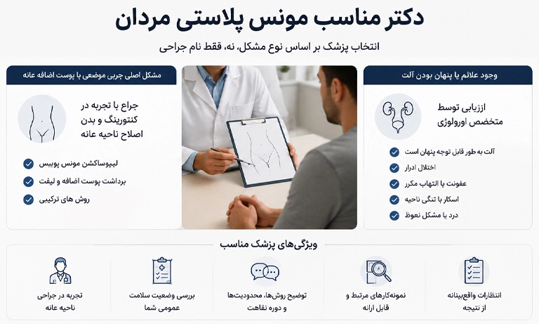 مونس پلاستی مردان