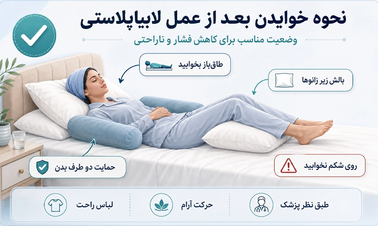 نحوه ی صحیح خوابیدن بعد از عمل لابیاپلاستی