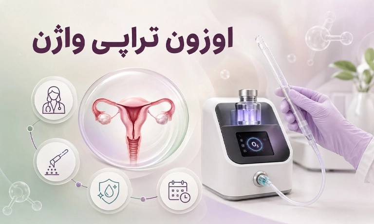 اوزون تراپی واژن چیست و ازن واژینال چگونه انجام می‌شود؟