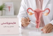 جراحی تنگی واژن