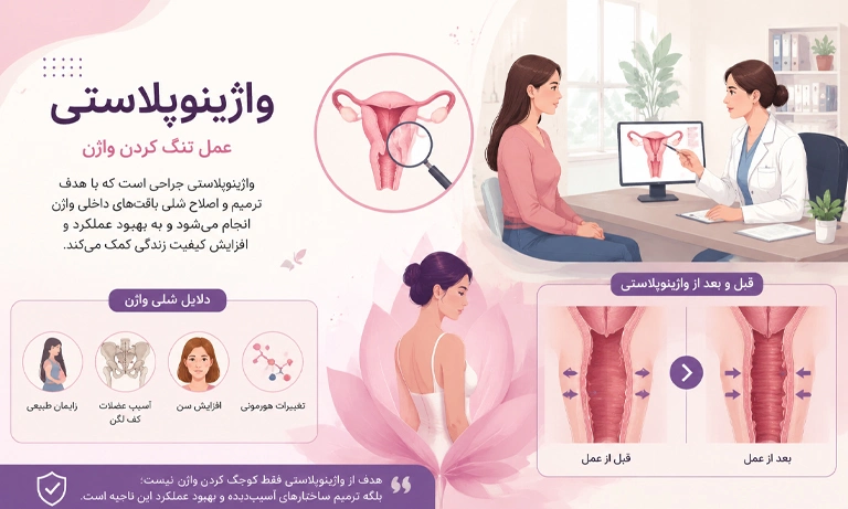 جراحی تنگی واژن