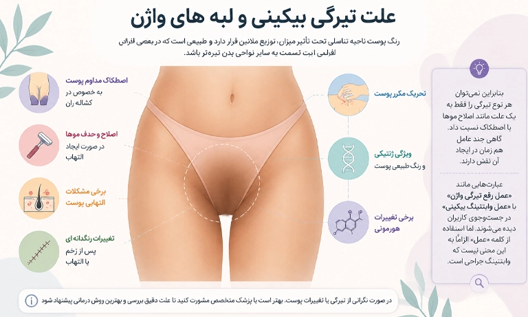 علت تیرگی بیکینی