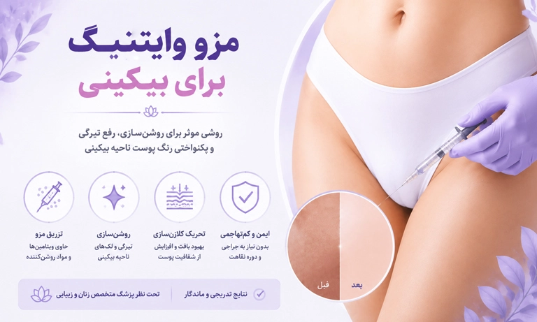 مزو وایتنینگ برای بیکینی