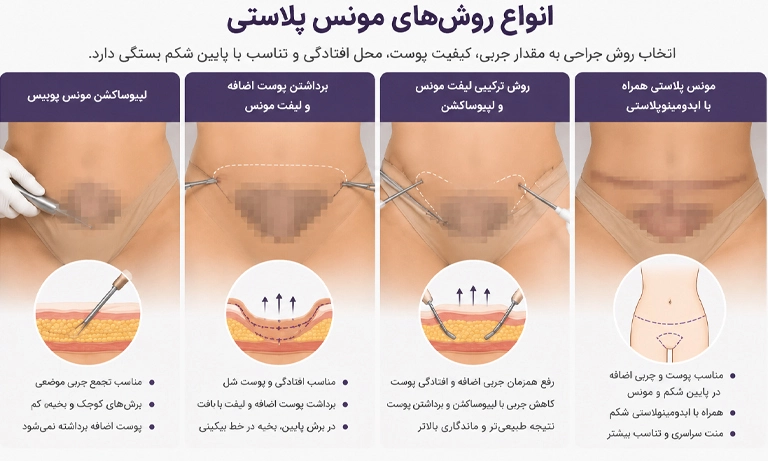 مونس پلاستی آقایان
