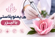 هایمنوپلاستی با لیزر