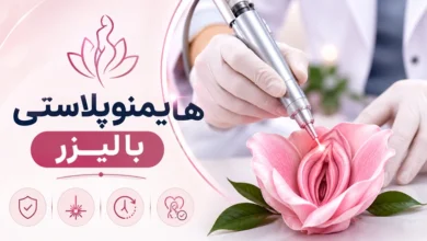 هایمنوپلاستی با لیزر