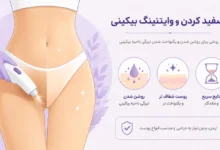 وایتنینگ بیکینی