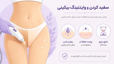 وایتنینگ بیکینی