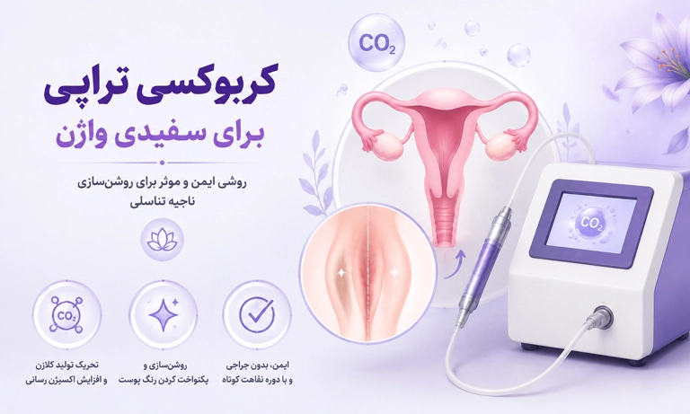 کربوکسی تراپی برای سفیدی واژن