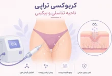 کربوکسی تراپی بیکینی و واژن