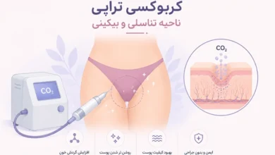 کربوکسی تراپی بیکینی و واژن
