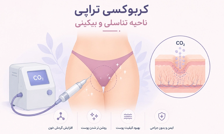 کربوکسی تراپی واژن و بیکینی چیست و چگونه انجام می‌شود؟