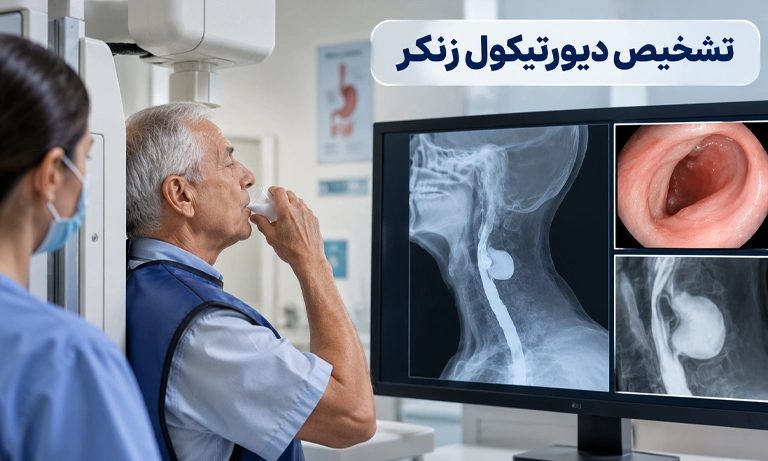 تشخیص دیورتیکول زنکر