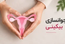 جوانسازی بیکینی