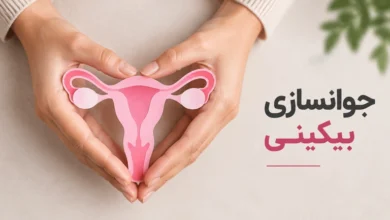 جوانسازی بیکینی