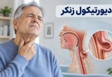 دیورتیکول زنکر