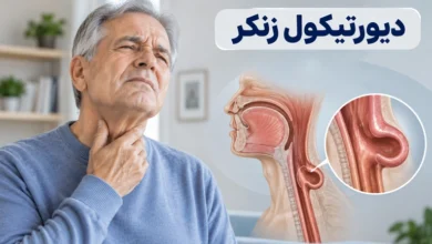 دیورتیکول زنکر