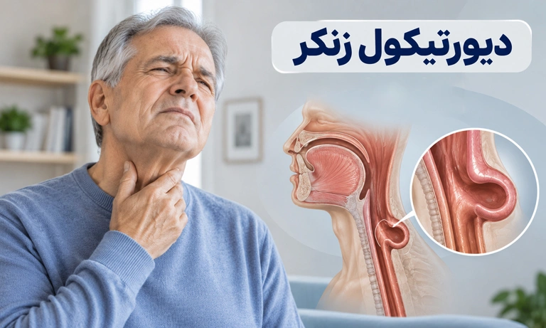 دیورتیکول زنکر