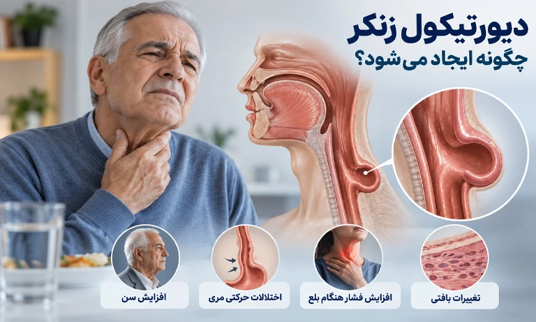دیورتیکول زنکر چگونه ایجاد یشود