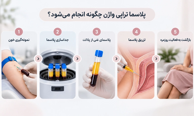نحوه ی عمل پلاسما تراپی واژن