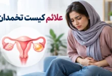 علائم کیست تخمدان